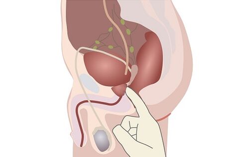 Anatomie der männlichen Prostata